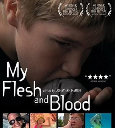 海报,My Flesh and Blood 图集